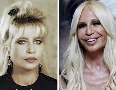 the face of versace|donatella Versace face what happened.